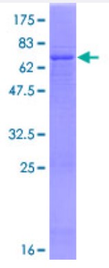 SDS-PAGE (RPE65-1234H).jpg